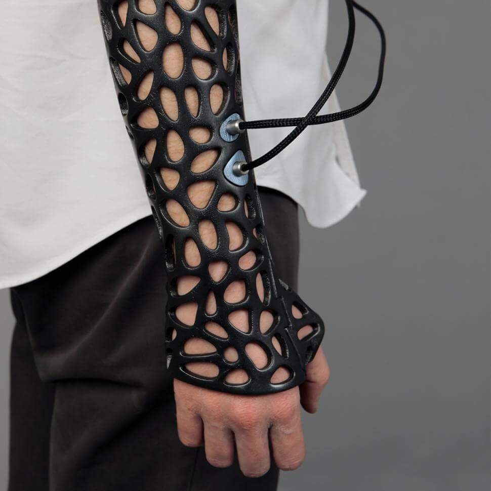 This 3D Printed Cast Can Heal Bones Up To 80% Faster