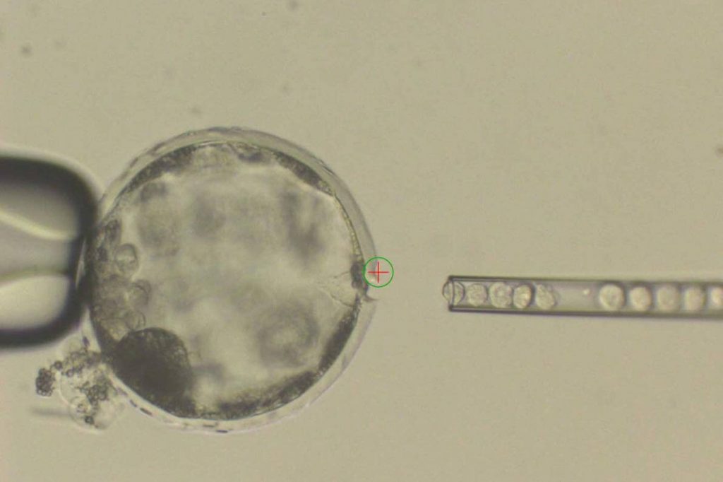 Injecting stem cells to create the human-pig chimera hybrid