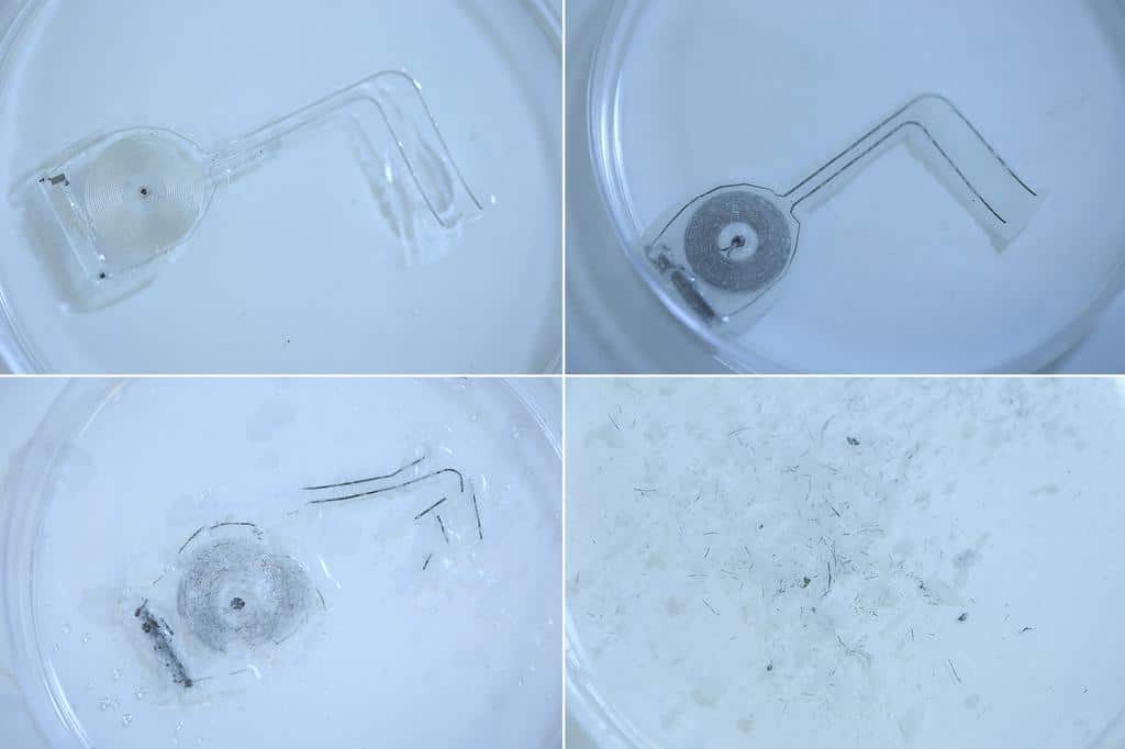 Dissolvable implants