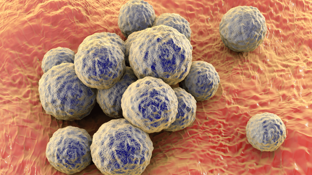 methicillin-resistant Staphylococcus aureus (MRSA)