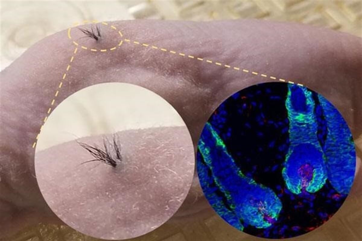 stem cell new hairs New hair follicles grow from stem cells