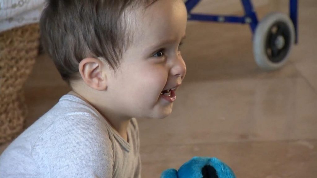 Charley had surgery for spina bifida while in the womb