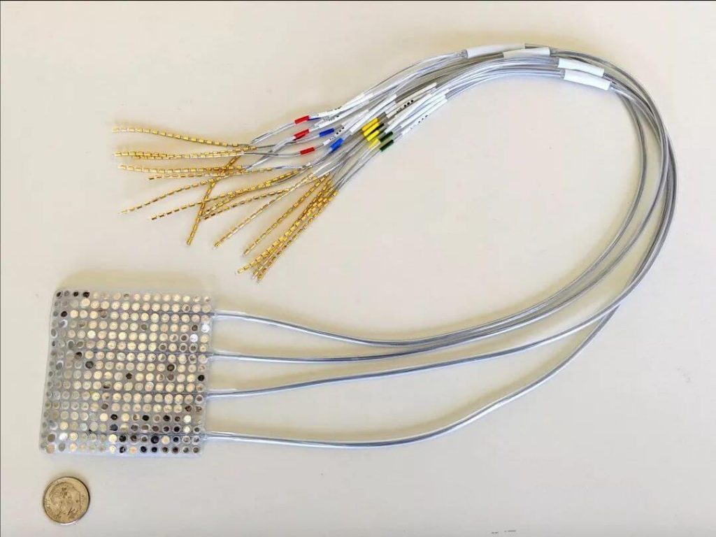 Electrode grid brain implant