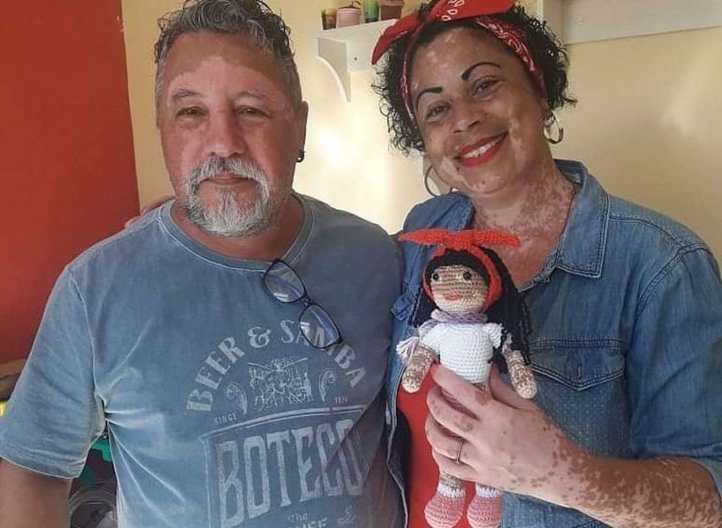 grandpa with vertigo knits dolls for kids with the same condition
