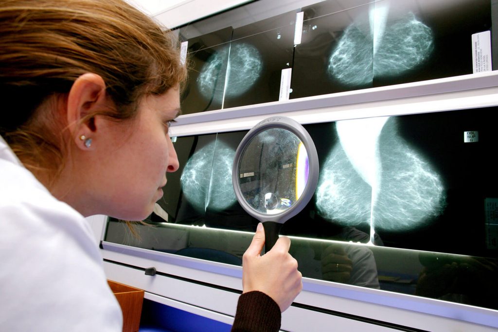 this smart young man develops a bra device that can identifying breast abnormalities and cancers early