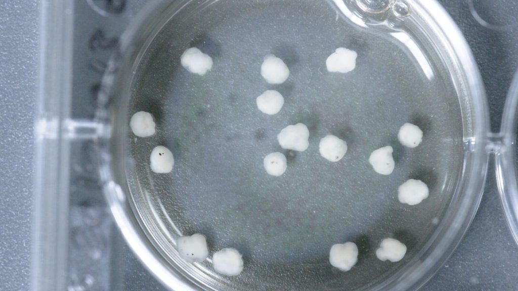 mini-brains