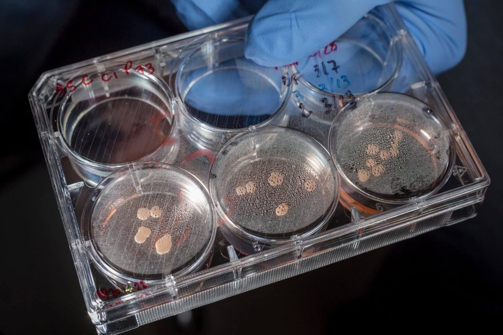 Mini-brains made in a lab