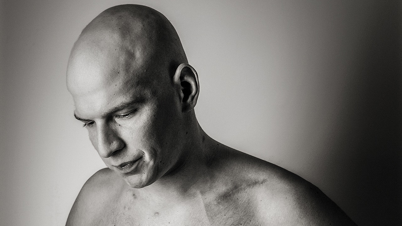 doctor treats himself for deadly disease and has been in remission ever since