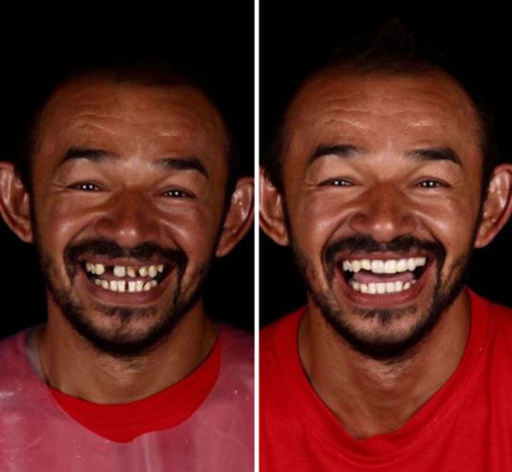 Brazilian Dentist Fixes Poor People’s Teeth For Free!