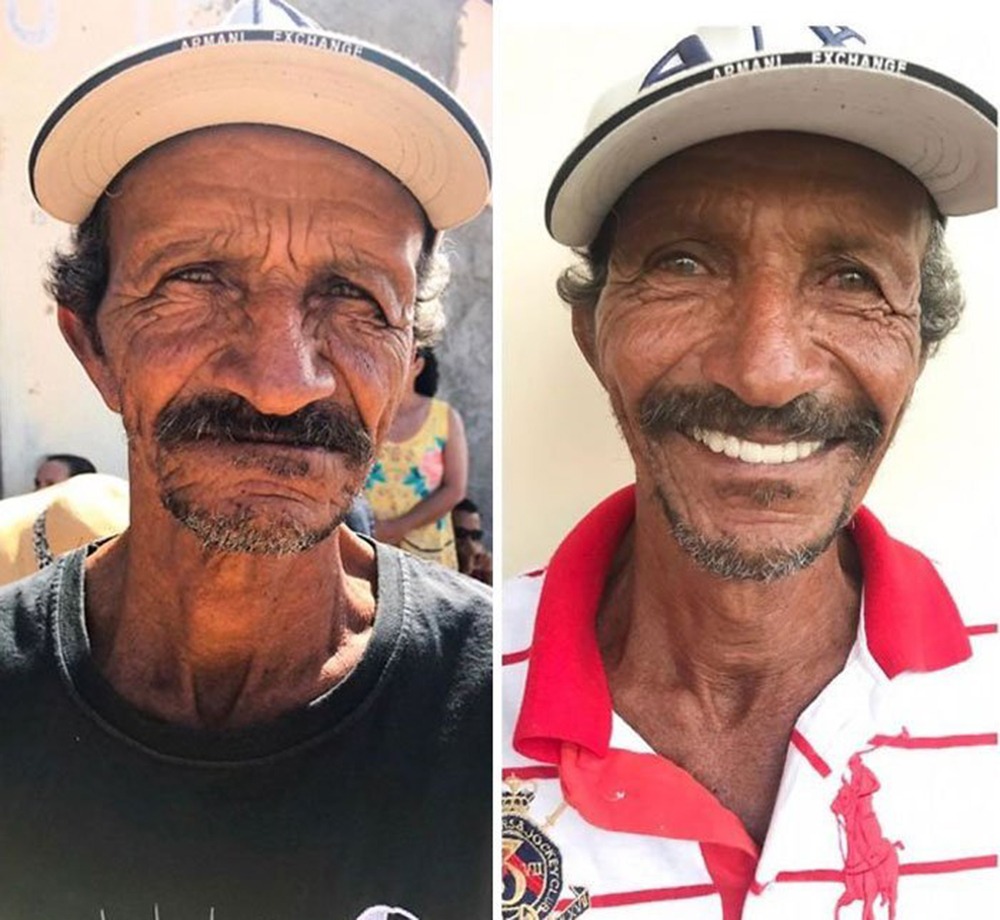 Brazilian Dentist Fixes Poor People’s Teeth For Free!