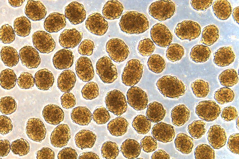 Insulin Secreting Cells Made From Human Stem Cells Cure Diabetic Mice