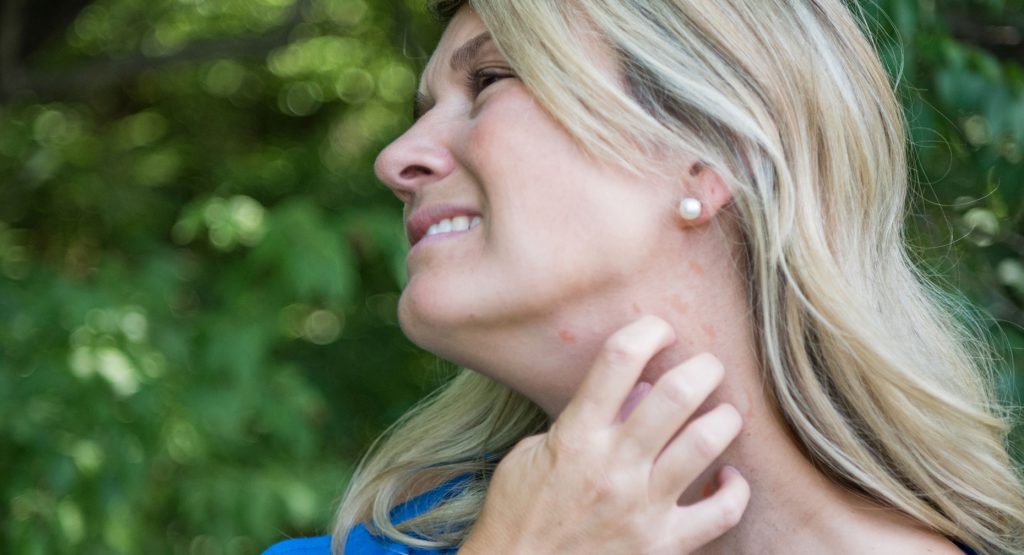 The Protein That Triggers Allergic Itching Has Been Identified