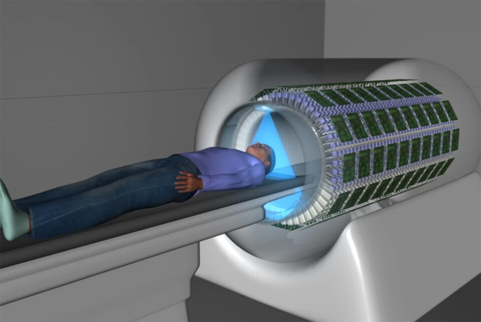 Full Body Radiography Full-Body Scans Find Exact Location of Chronic Pain
