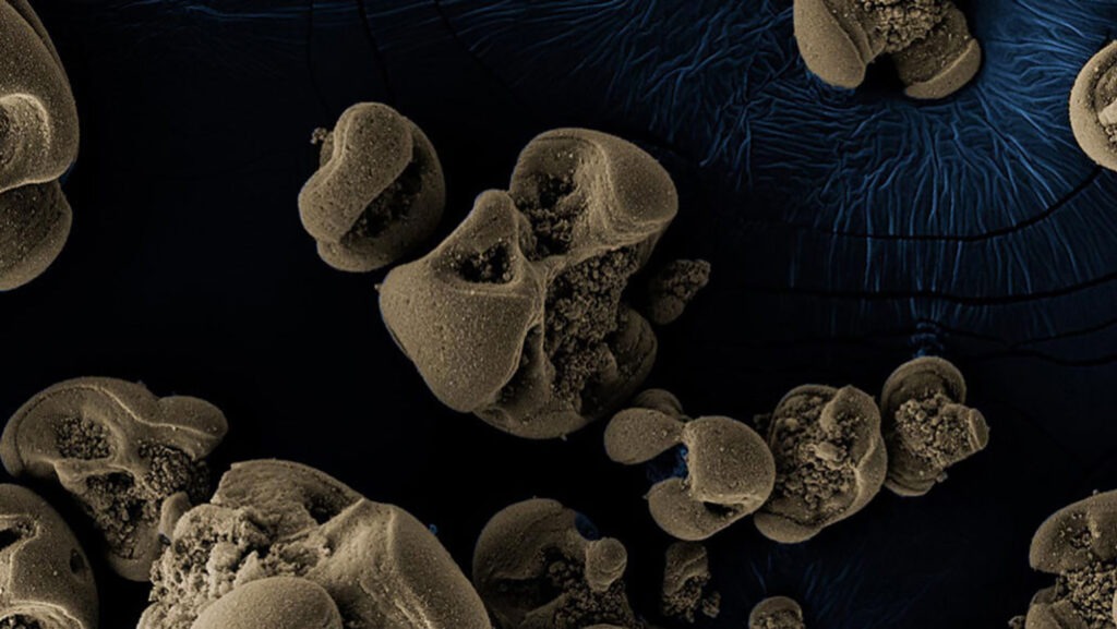 A Pair Of Scientists Discover Metal-Eating Bacteria