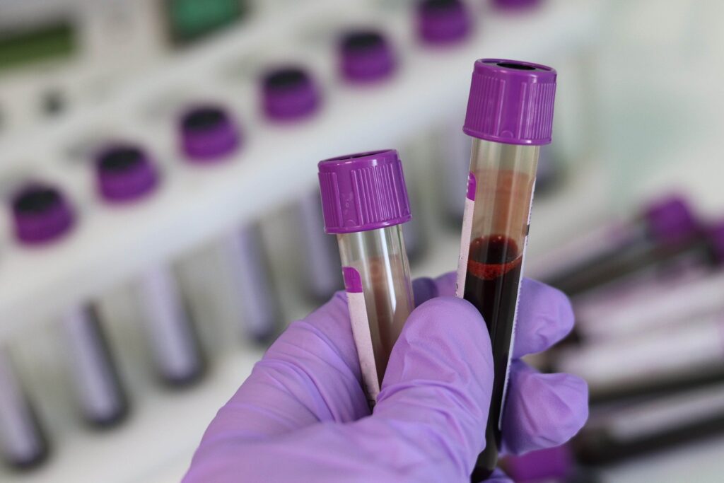 PanSeer Blood Test Catches Cancer At Earliest Stage Than Ever Before