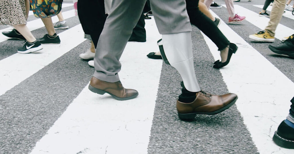Robotic Prosthetic Knee Wins This Year's Red Dot: Luminary Award