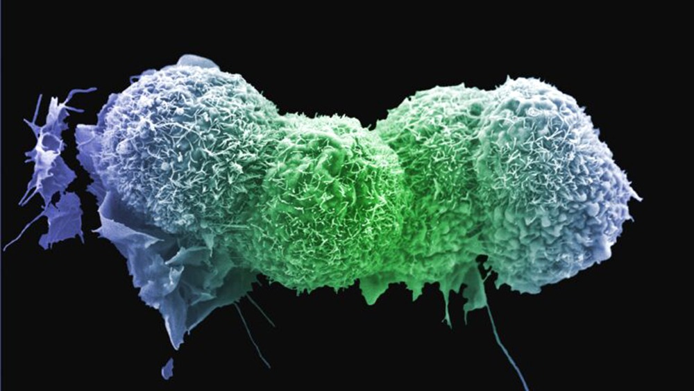 Stress Hormones Can Activate Dormant Cancer Cells