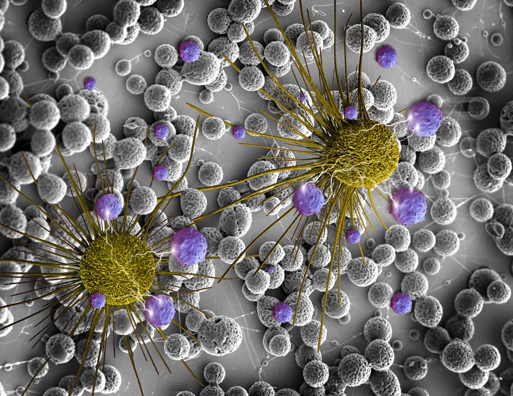 New Immunotherapy Tricks Tumor To Kill It From Within
