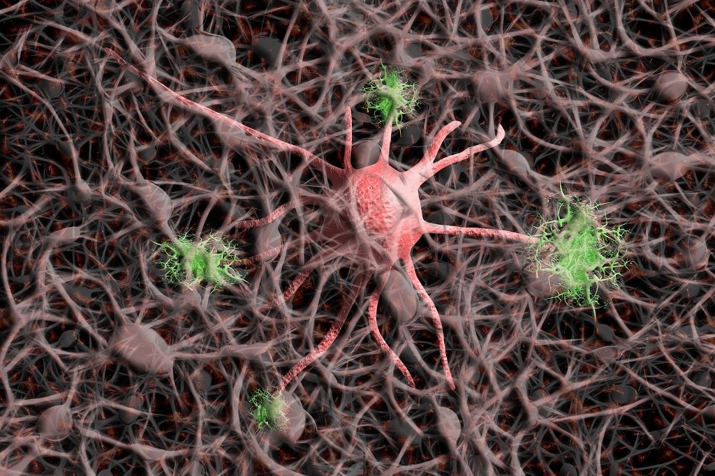 Human Trials of A Promising Dementia-Fighting Drug Will Begin Soon