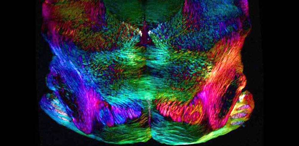 Scientists Found A Way To Reverse Age-Related Memory Loss