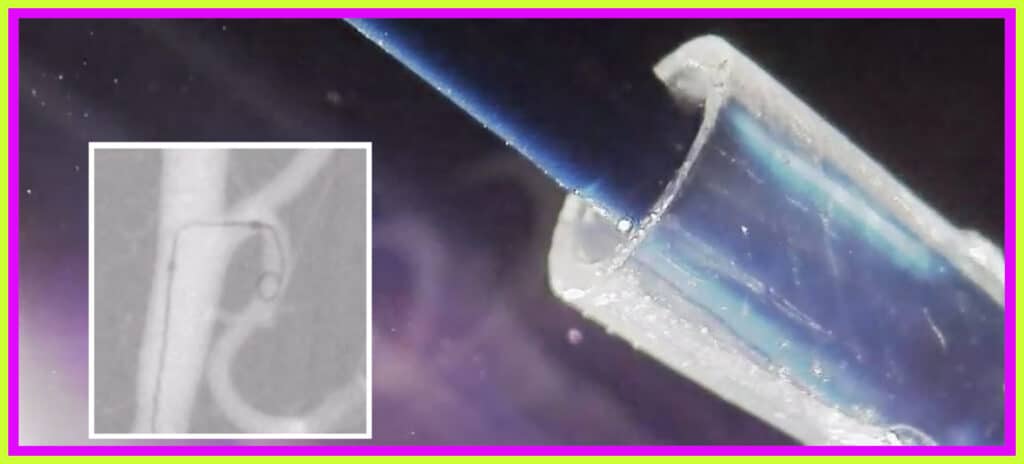 Insect-Inspired Steerable Catheter To Treat Hard-To-Reach Aneurysms