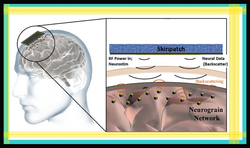 New Miniature Implants Could Drastically Improve BCIs