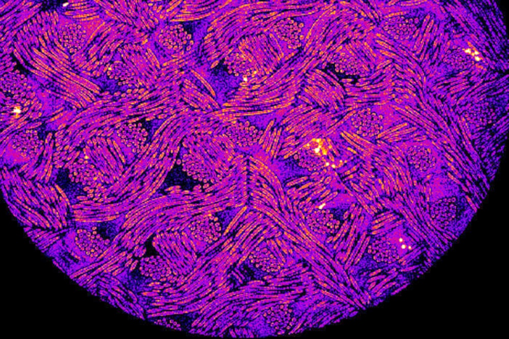 A microscopic image of an implant made of a woven scaffold coated with engineered cartilage cells programmed to release a drug in response to inflammation.