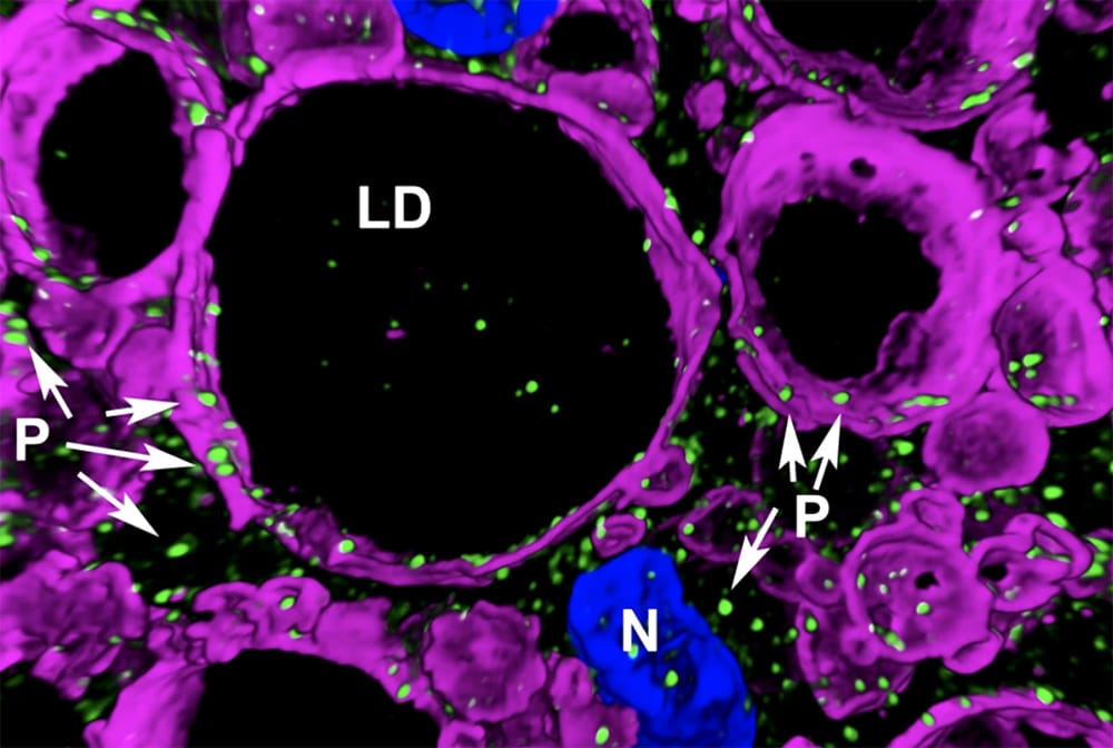 These Studies Hack Molecular Pathways Involved With Obesity