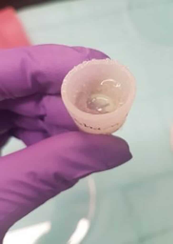 Functioning Re-Grown Frog Legs Offer Hope for Humans Who Lost Limbs