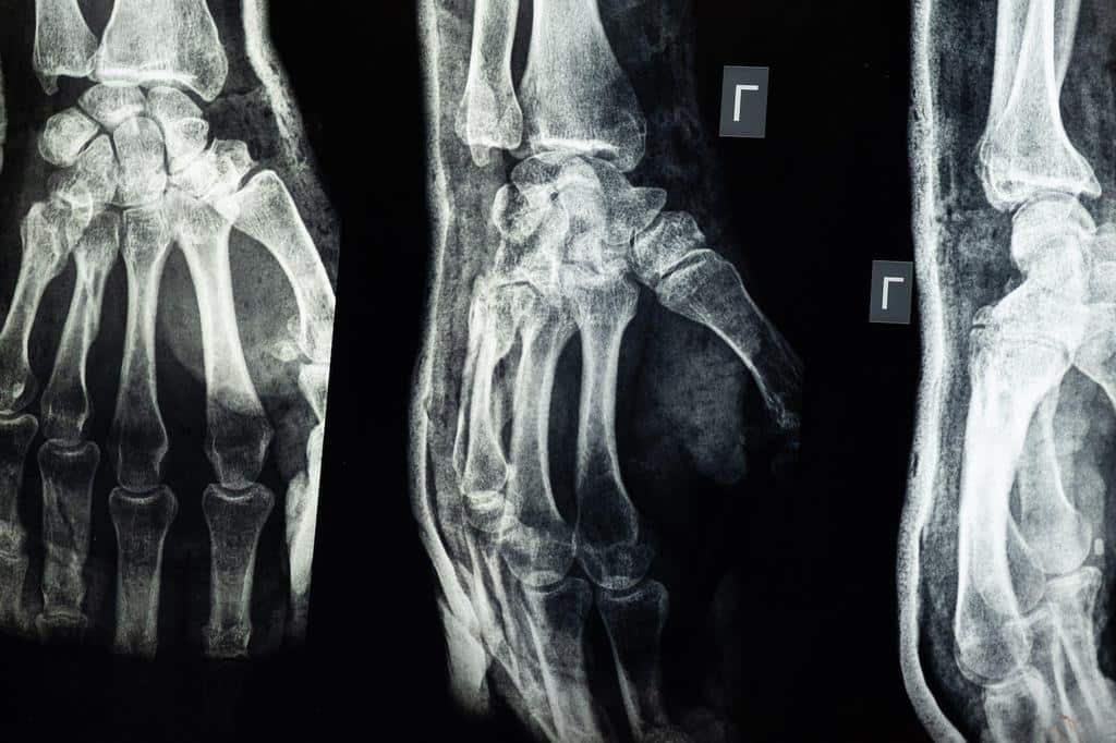 X-ray