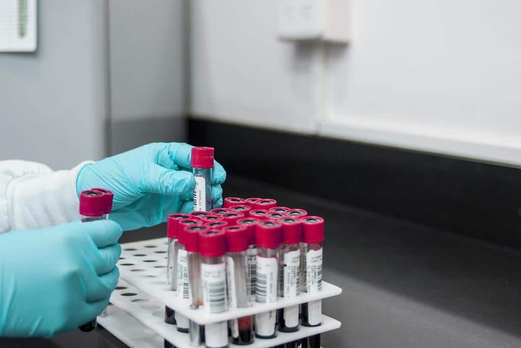 From Spit Tests to Oral Swabs: The Top Methods for Drug Detection