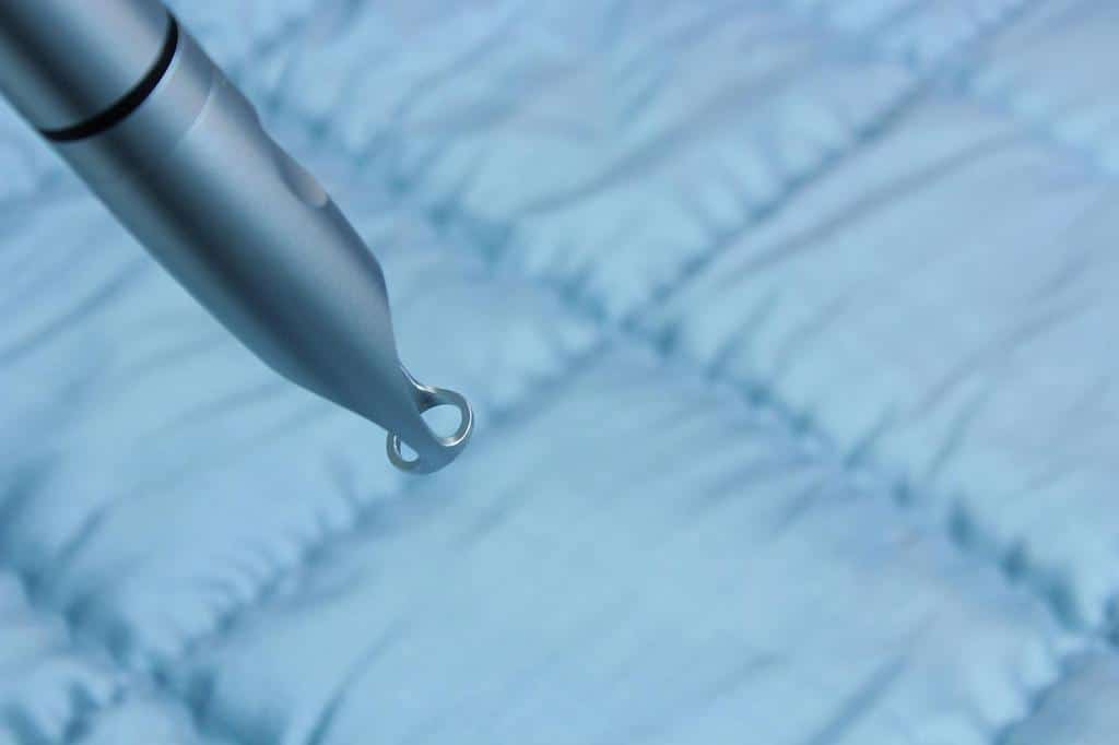 Microneedling is a highly effective and minimally invasive aesthetic treatment that has gained significant popularity for its ability to rejuvenate the skin and address a range of skin concerns.