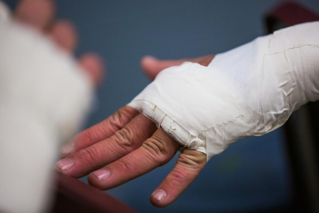 Hand injury