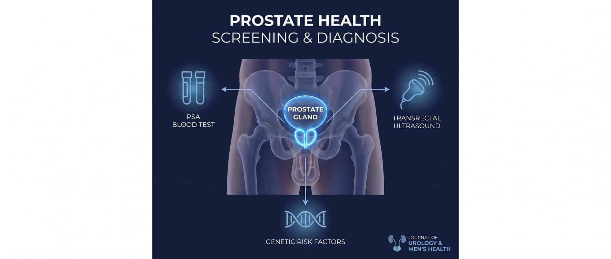 Medical infographic highlighting prostate gland anatomy with PSA screening icons