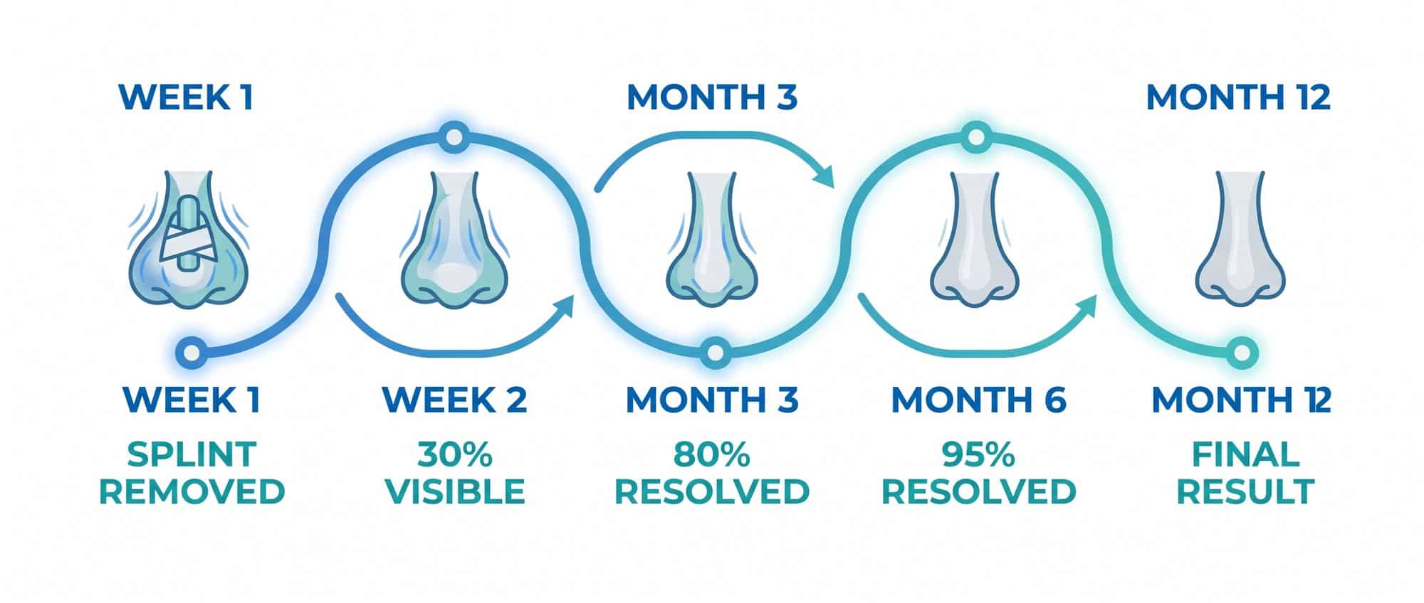 Rhinoplasty recovery timeline infographic showing swelling resolution stages from week 1 to month 12
