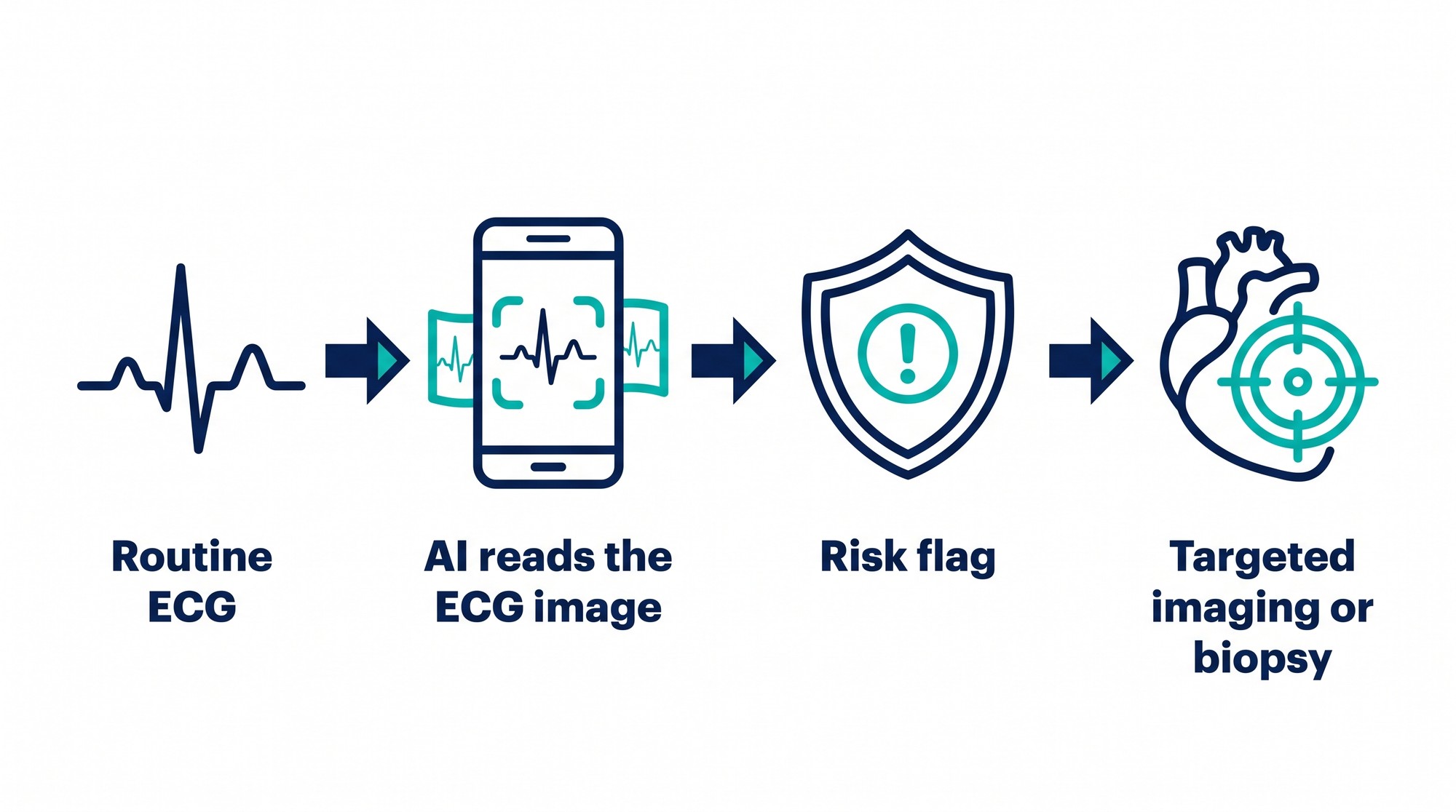Diagram of how AI ECG screening fits into the care pathway, from routine ECG to targeted imaging